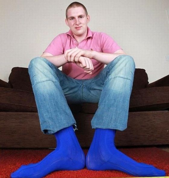 Carl Griffiths Has The Largest Feet In Britain Pics Video