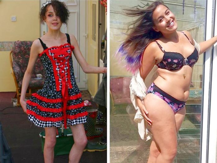 Babe Beats An Eating Disorder To Become A Full Figured Beauty Pics