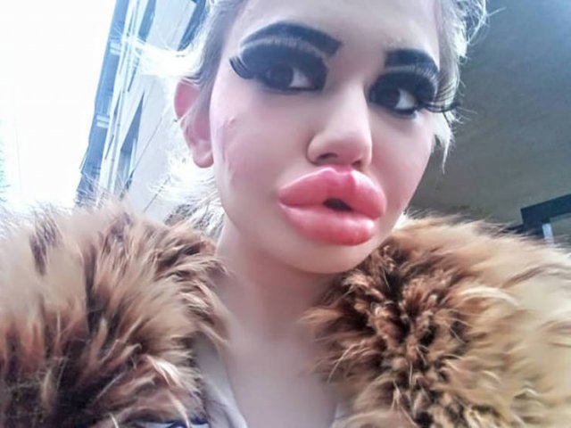 Bulgarian Girl With World S Largest Lips 21 Pics