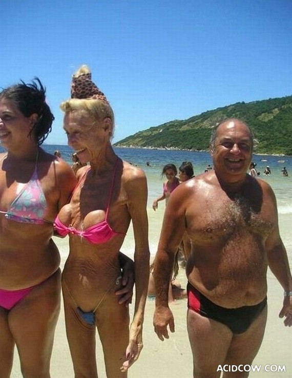 How the Silicone Boobs Look When You Are 60 (7 pics)