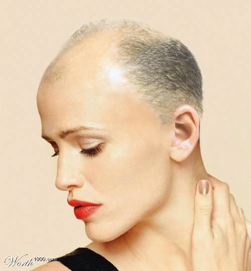 Bald celebrities (28 pics)