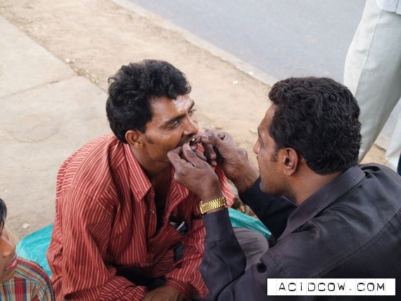 The street dentist in India (13 pics)