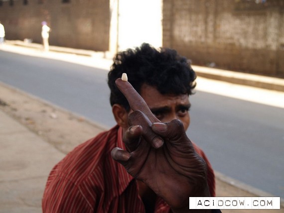 The street dentist in India (13 pics)