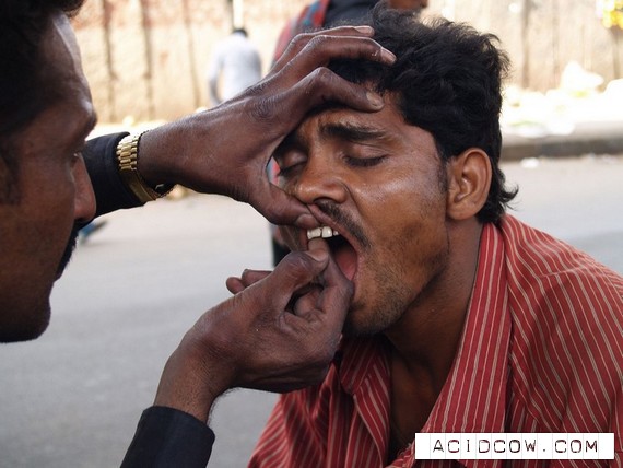 The street dentist in India (13 pics)