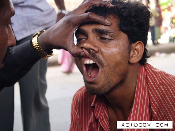 The street dentist in India (13 pics)