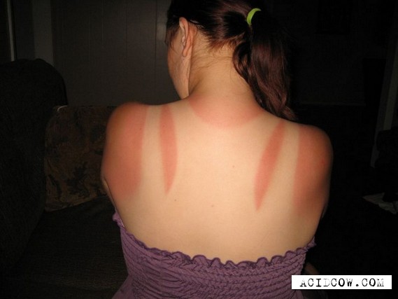 Cautiously, the burn is possible! (20 pics)