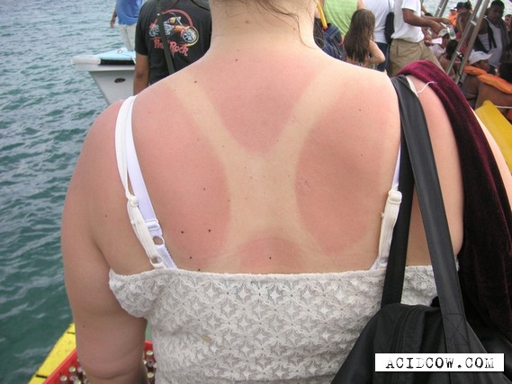 Cautiously, the burn is possible! (20 pics)