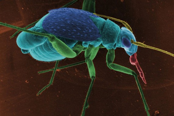Insects Under a Microscope (32 pics)