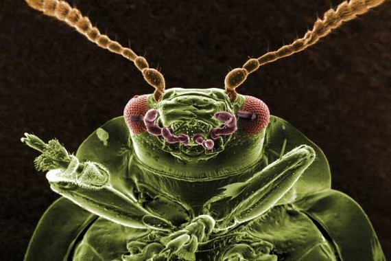 Insects Under a Microscope (32 pics)