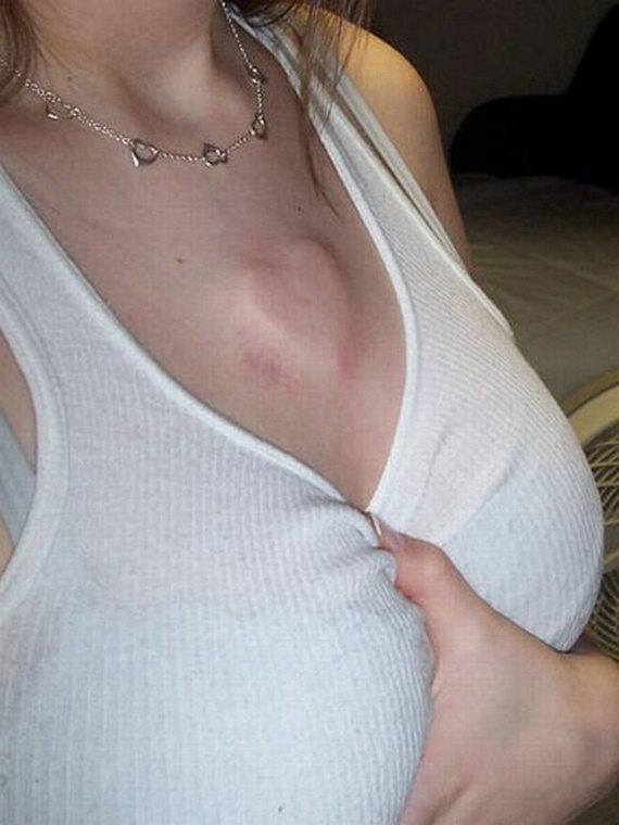 Piercing gets under your skin (18 pics)