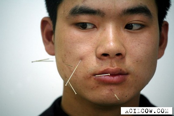 Chinese traditional medicine (11 pics)