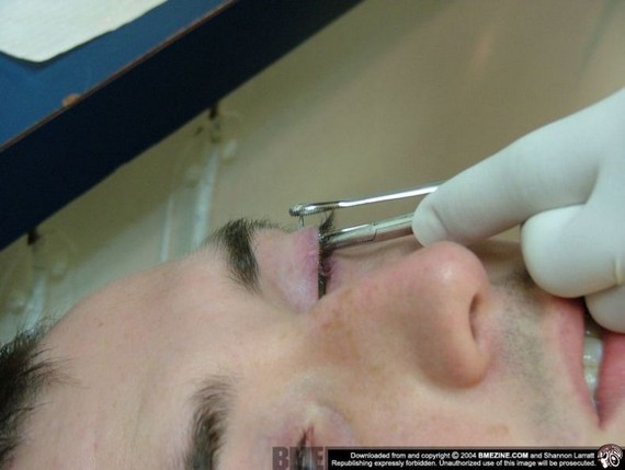 Hit of the Day! Piercing on eyelid (17 pics)