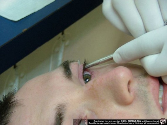 Hit of the Day! Piercing on eyelid (17 pics)