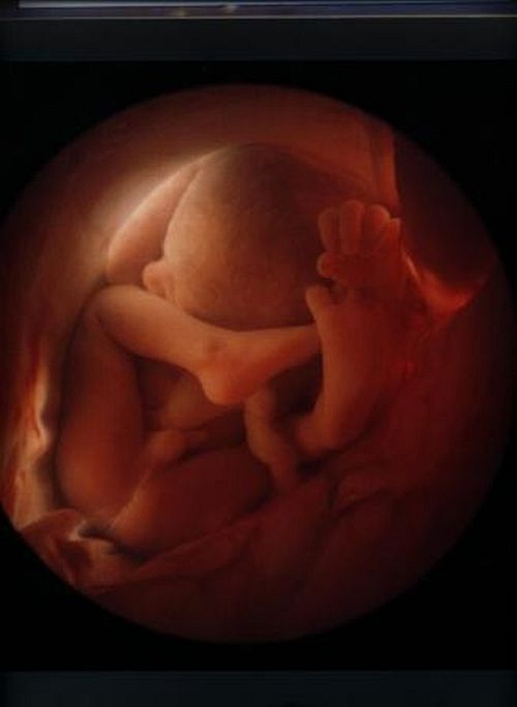 Малыш на 18 неделе беременности фото