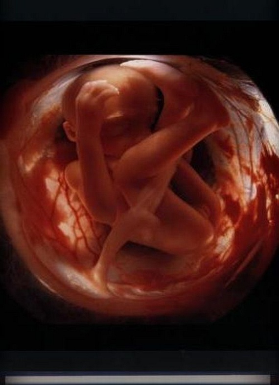 Pregnancy (13 pics)