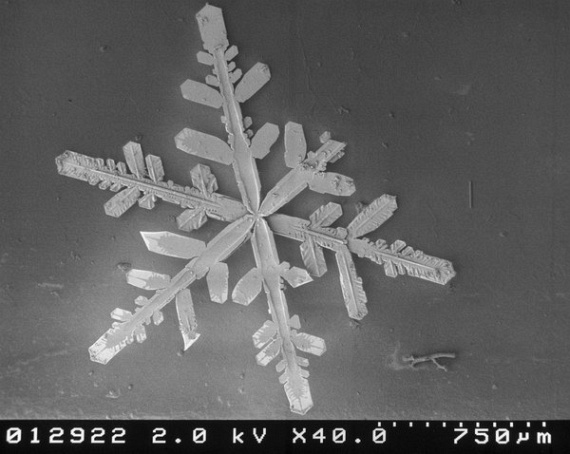 Snow Under A Microscope (23 pics)