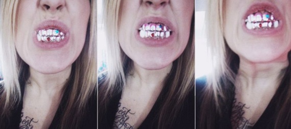 Bling teeth (52 pics)