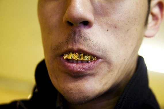 Bling teeth (52 pics)