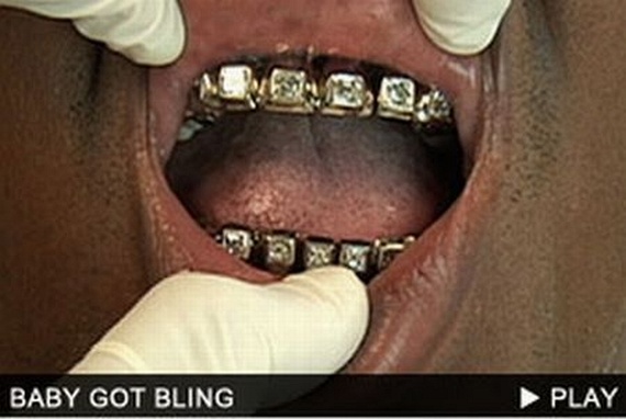 Bling teeth (52 pics)