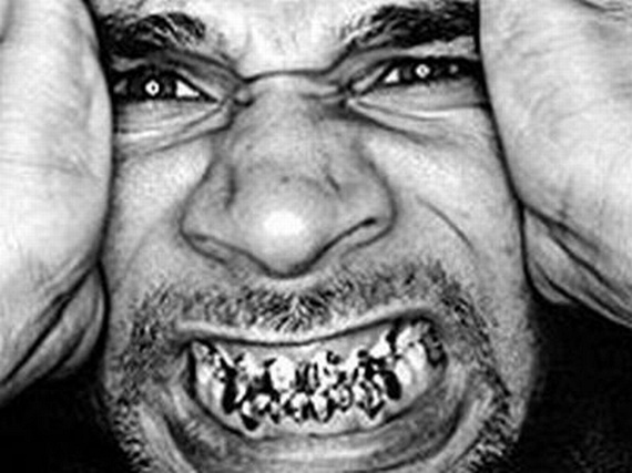 Bling teeth (52 pics)