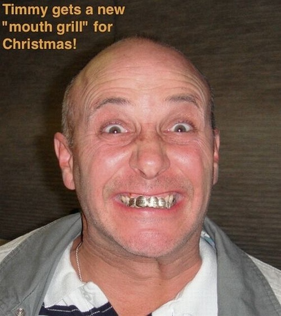 Bling teeth (52 pics)