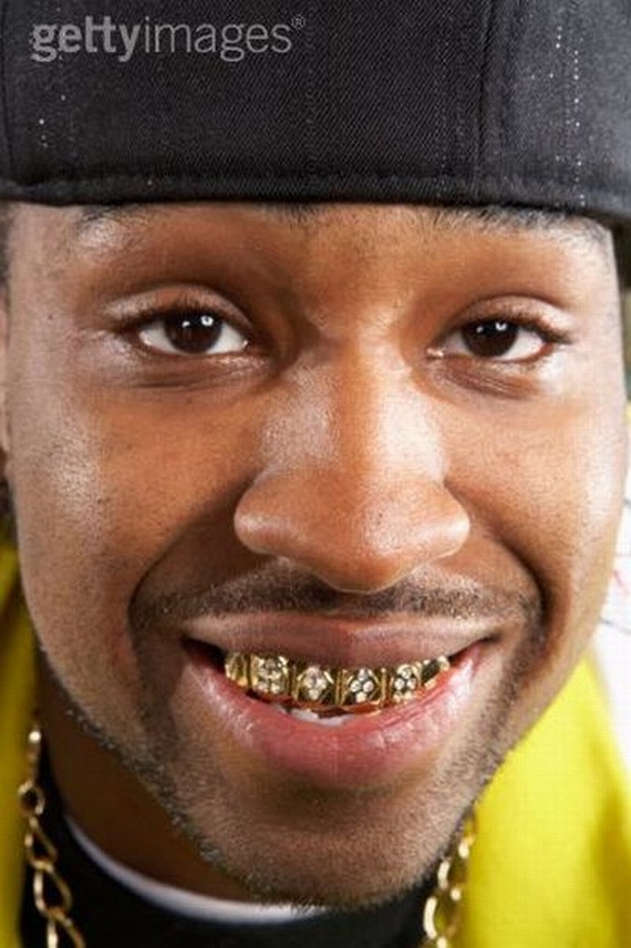 Bling teeth (52 pics)