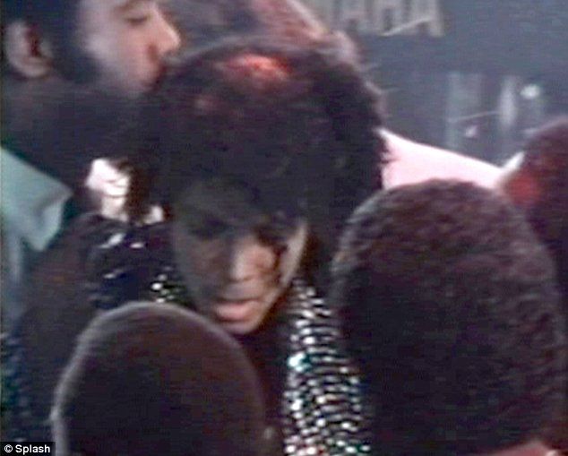 Michael Jackson's hair on fire (12 pics)