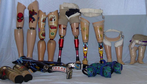 Cody McCasland and his amazing spirit (13 pics)
