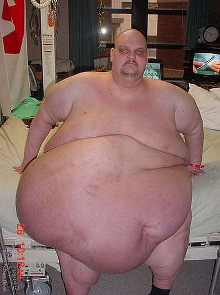 Patrick Duel and his weight loss  (18 pics)