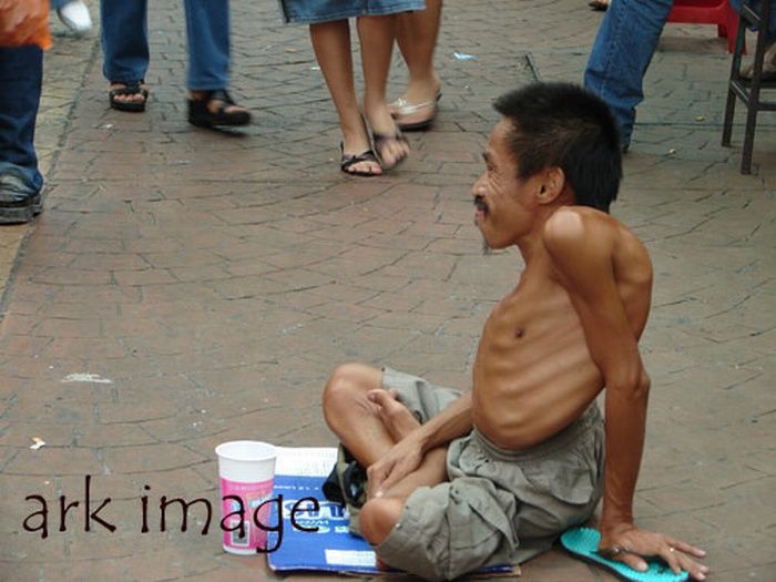 Crippled beggars of India (17 pics)