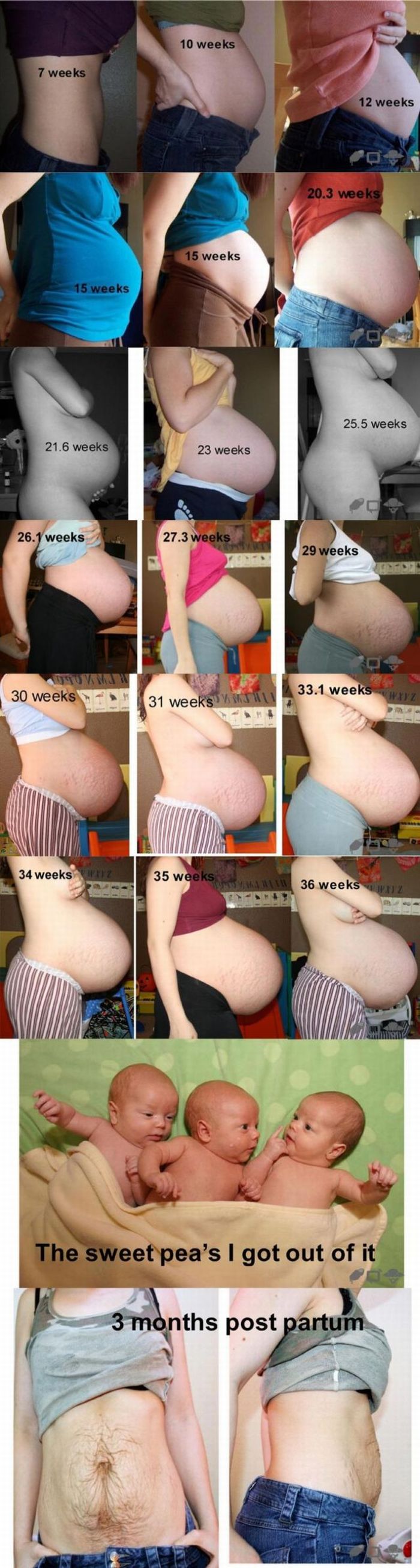 Pregnant Woman (21 pics)