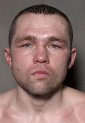 Boxers before and after a fight (12 pics)