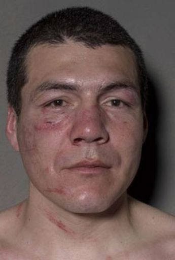 Boxers before and after a fight (12 pics)