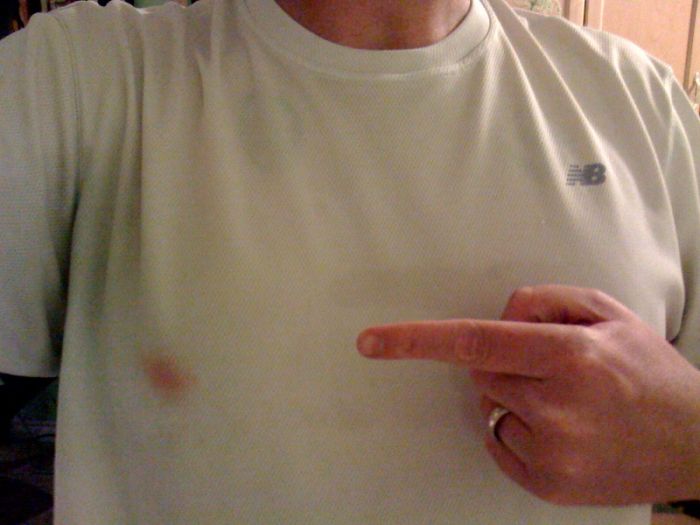 Ouch. Bloody Nipples (12 pics)