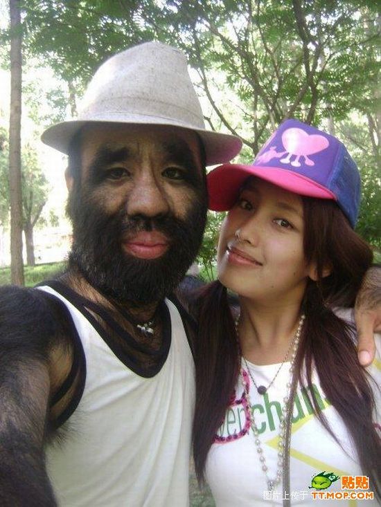 World's hairiest man and his girlfriend (11 pics)