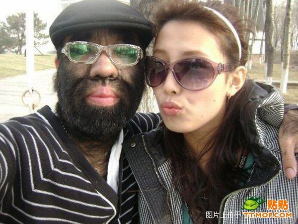 World's hairiest man and his girlfriend (11 pics)