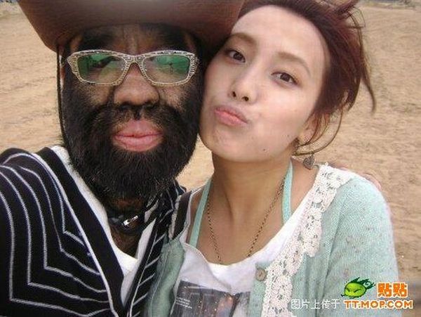 World's hairiest man and his girlfriend (11 pics)