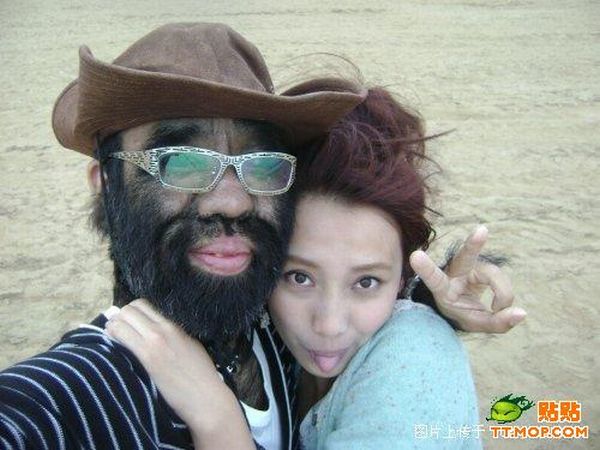 World's hairiest man and his girlfriend (11 pics)