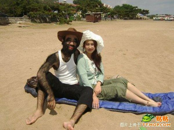 World's hairiest man and his girlfriend (11 pics)