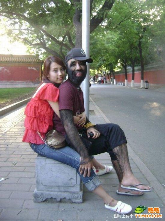 World's hairiest man and his girlfriend (11 pics)