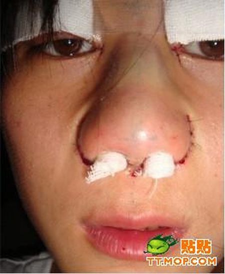 Before And After Cosmetic Surgery (18 pics)