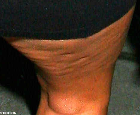 Body Parts, That Celebrities Don't Want Us To See (63 pics)