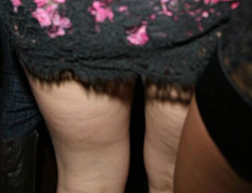 Body Parts, That Celebrities Don't Want Us To See (63 pics)