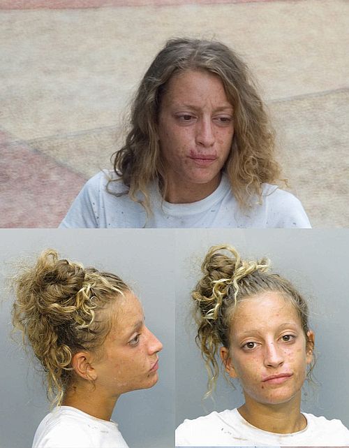 What Too Much Drugs Can Do To You (56 pics)