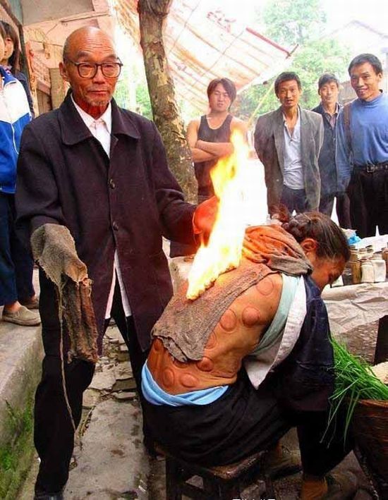 Street Medicine In China (7 pics)