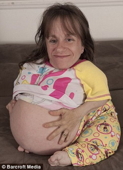 World's Smallest Mother is Pregnant Again (7 pics)