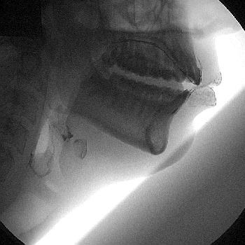 X-Ray Analyse of Speech (2 gifs)