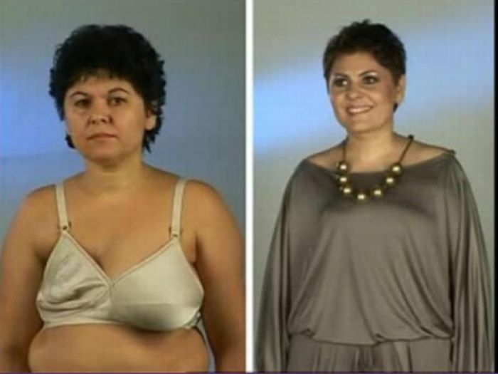 Romanian TV Show. Before and After Plastic Surgery (31 pics)