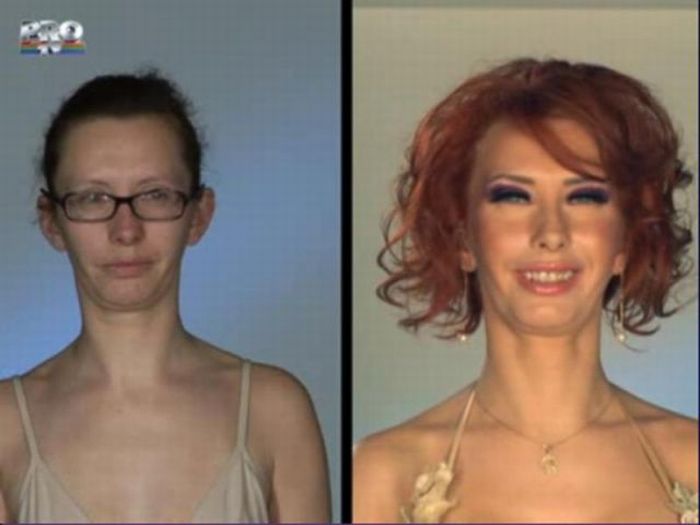 Romanian TV Show. Before and After Plastic Surgery (31 pics)