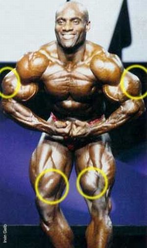 Synthol Side Effects